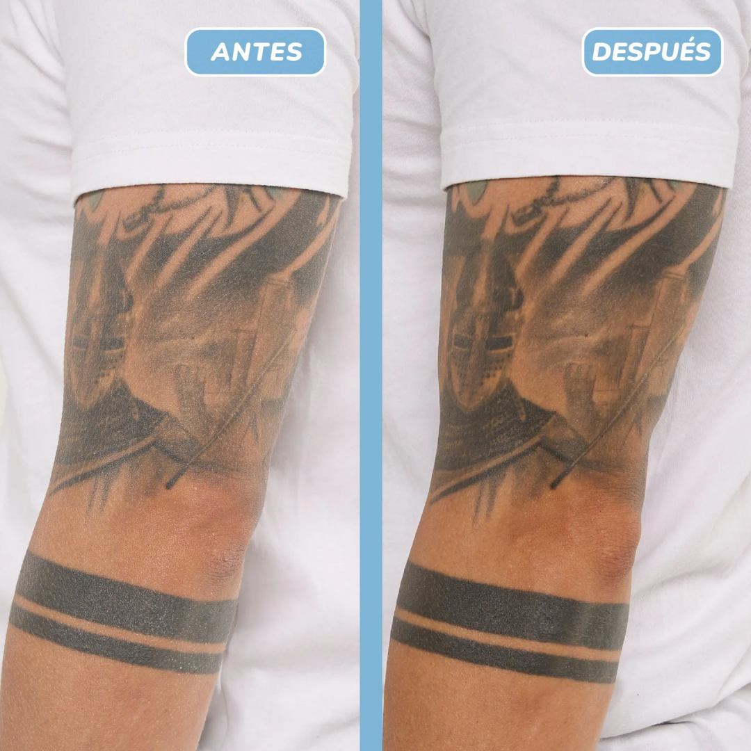 foto de antes y despues de usar el bio emulsion de aruná.